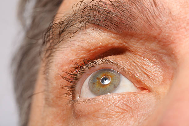 Glaukoma Sekunder Penyebab, Gejala, dan Pengobatan